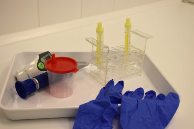 Ein Urinproben-Set im Gesundheitsamt